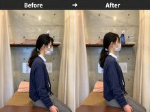 リセット整骨院しぎの院/BeforeAfter