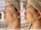 エービューティーサロン 松山店(A BEAUTY SALON.)の写真