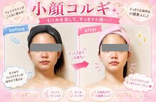 セレブリティ(Celebrity)