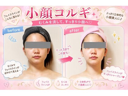 セレブリティ(Celebrity)の写真