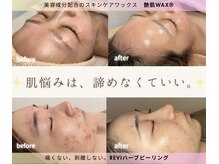 リルビー(Lilby)