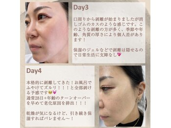 ハーバリー ハーブピーリング 岐阜(HERBERRYハーブピーリング)/ハーブピーリング専門店HERBERRY