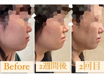 サロン ヌーク(salon Nook)/フェイスラインのケア