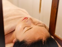 グレース(Grace)/シロダーラ