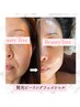 【肌のくすみ、毛穴が気になる方】初回9,800円♪発光ピーリング