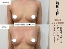 ソワ(soie)/圧倒的な張り・ボリューム