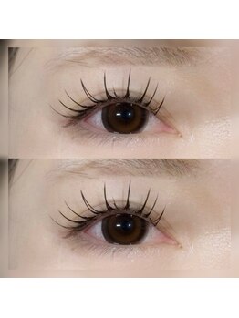 フロラ(Flora)の写真/大人気のバインドロック