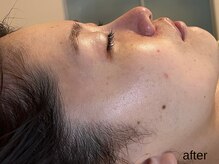 サロン ド エメ(salon de aimer)/【After】透明感アップ