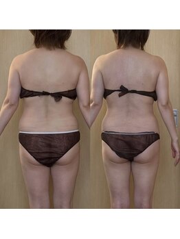 ココア(CoCoa)/活性リンパ洗浄