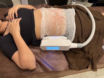 ミセル mozoワンダーシティ店(MYTHEL)/脂肪冷却