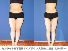 アンシャンテ 神戸元町店(Enchante)/痩身ダイエット　神戸元町三ノ宮