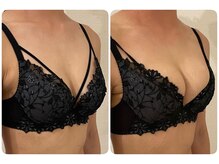 モナンジュ(ramonange)/初体験のお客様　before after