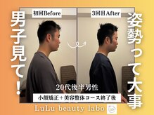 ルルラボ(LuLu beauty labo)/3回でこれだけ変わる！