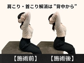 パルマ なかもず(Palma)/肩こり・首こりは背中から！