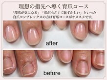 ビビネイル(BIBI Nail)の雰囲気（爪の傷みが気になる方はご相談ください。パラジェル/フィルイン）
