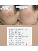 ルルボーテ(Loulou Beaute)/waxxxx＋VOSサロンケア