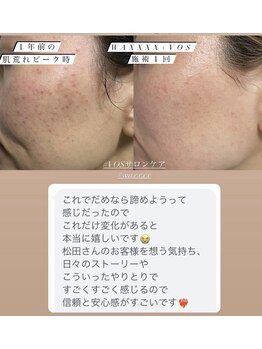 ルルボーテ(Loulou Beaute)/waxxxx+VOSサロンケア