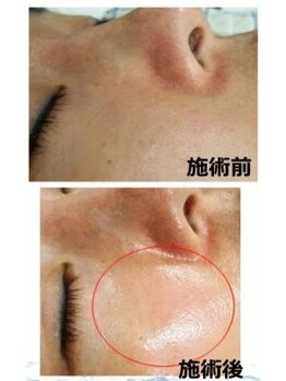 ラディア(Radia)/