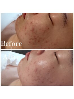 エステティックス ナインワンワン 横浜(Esthetics911) /フェイシャル1回施術で効果◎