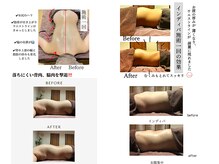 グランツ 小山店の雰囲気（インディバ深部温め、内蔵温めの効果をぜひ体験ください。）