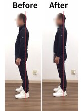 リライフ/Before/After