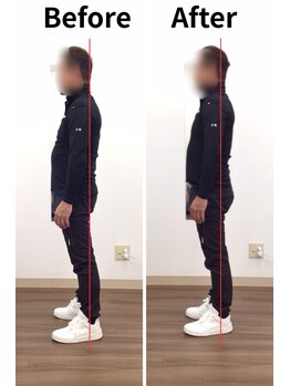 リライフ/Before/After