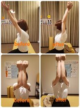 若松整体院 太白区院/肩甲骨はがし＆骨盤矯正★