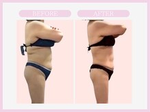 スリムライン 盛岡店(The Slim Line)/before→after