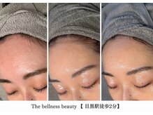 ザ ベルネス(The bellness)/【セルマン】肌改善・ピーリング