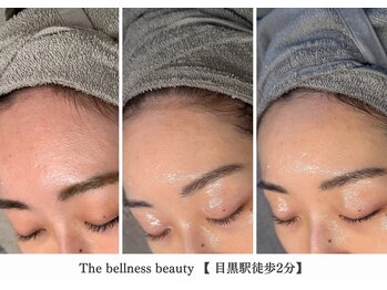 ザ ベルネス(The bellness)/【セルマン】肌改善・ピーリング