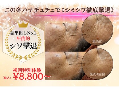 ハナチュチュ 矢場町店(Hanachuchu)の写真