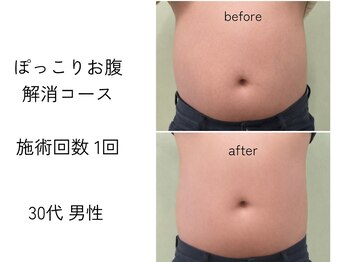 ほねつぎ一休さん 宇品店/ぽっこりお腹解消コース