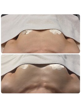 ルナリア ルクス 志木南口駅前店/バストアップ　下垂　左右差