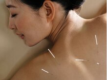 鍼灸からだケア 元住吉 ［肩凝り・腰痛改善/もみほぐし・ストレッチ・リンパ・整体］/