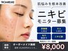 [特別モニター] 繰り返すニキビを根本改善｜肌診断＋オーダーメイド肌管理