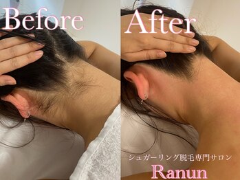 ラナン(Ranun)/毎日が快適になるシュガーリング