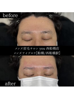 ユー 西船橋店(you)/ビフォーアフターお写真