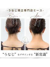 ミース 長野店/うなじ矯正◆ビフォーアフター
