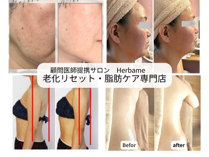 エルブラン(Herb ame)の写真