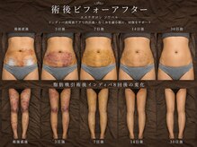 ソワベル(SoieBelle)の雰囲気(東京でも希少!インディバ×エンダモで術後、痩身ワンランク上へ)