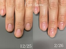 オープンセサミ 練馬/艶々ジェル地爪育成/石神井公園