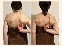ラフリー 武蔵小杉院(RUFFREE)/肩こり改善に肩甲骨はがし