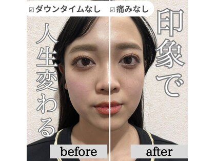 女性専用整体サロン フレル(Frele)の写真