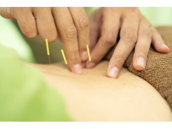 アスミルはり灸接骨院 金山駅前院/鍼施術