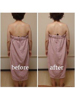 ココプレジール(Cocoplaisir)/巻き肩/猫背/肩甲骨周り