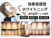 ベティー(Betee)