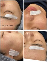 アンベリィ(Embellir)/お肌に優しいワックス脱毛♪