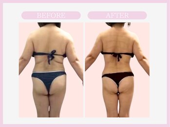 スリムライン 盛岡店(The Slim Line)/before→after