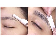 ご希望に合わせて選べる、2つの施術