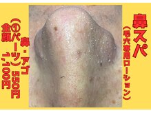 大人気！【鼻スパ】550こびり付いた角栓もニョキニョキ